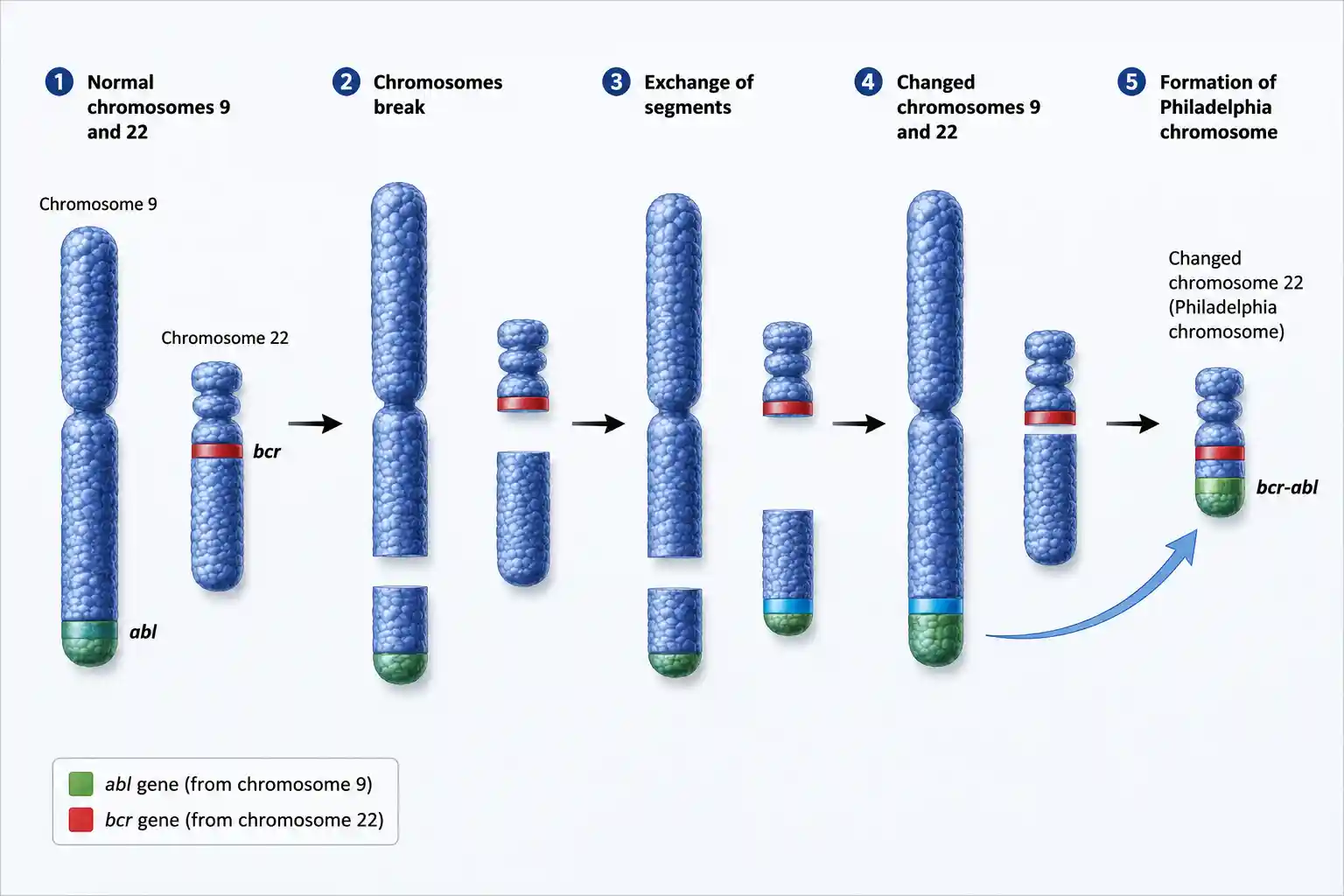 Diagram showing how chromosomes 9 and 22 break and swap to form the Philadelphia chromosome with the BCR-ABL fusion gene